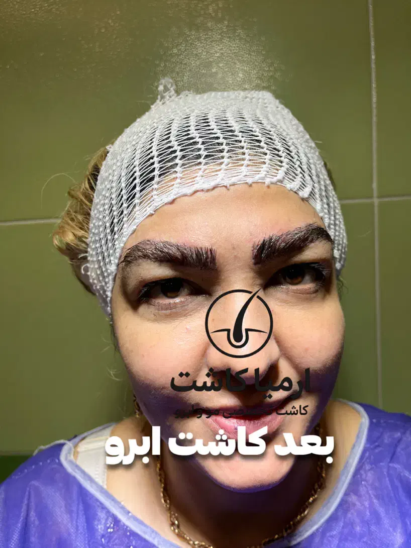 مدل کاشت ابرو|خدمات آرایشگری و زیبایی|گرگان, |دیوار