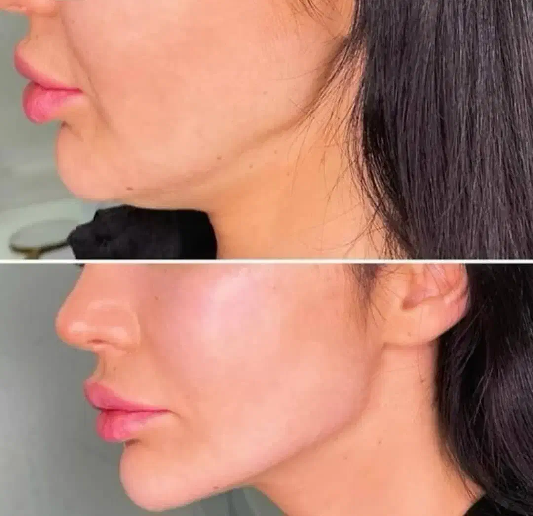 آف ویژه بالن وبوتاکس معده،ژل و بوتاکس وبفاروپلاستی|خدمات آرایشگری و زیبایی|اهواز, کیانپارس |دیوار