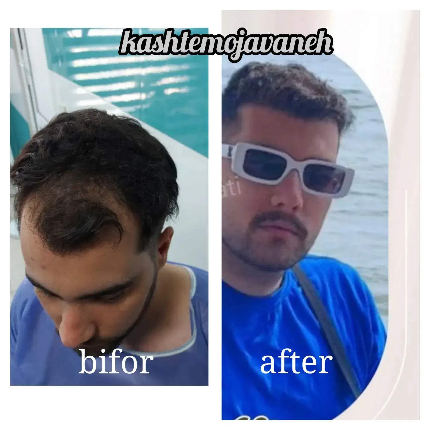 جشنواره یلدایی کاشت موشیرازی از۱۳تومن|خدمات آرایشگری و زیبایی|تهران, صد دستگاه|دیوار