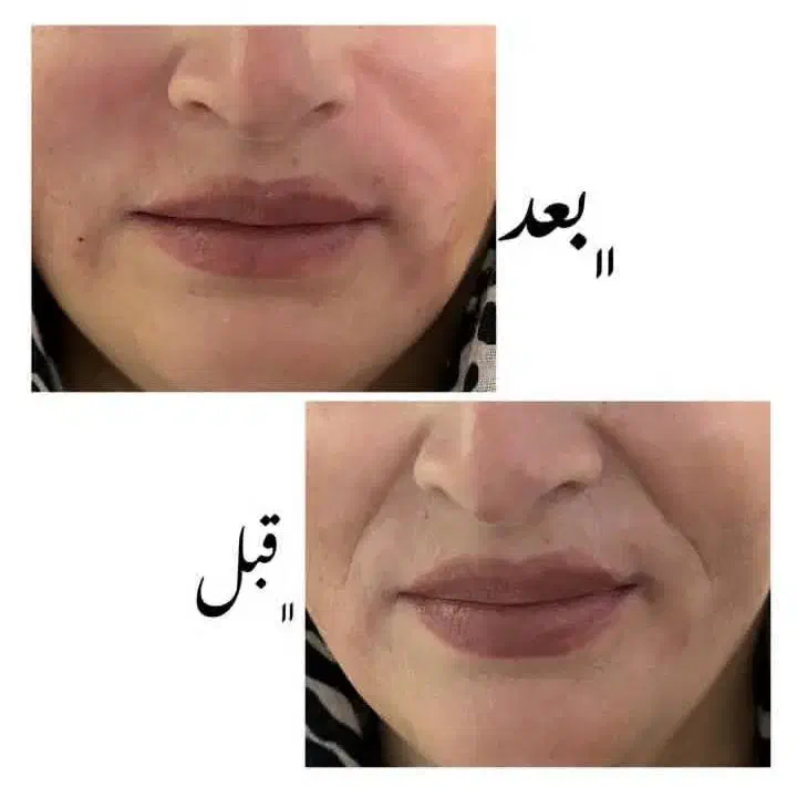 کلینیک زیبایی آذربایجان|خدمات آرایشگری و زیبایی|گرمی, |دیوار