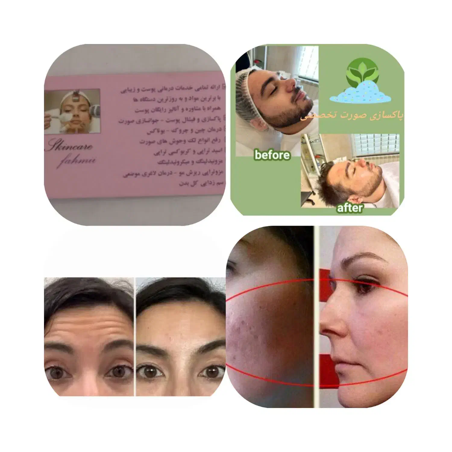 جشنواره آموزش ژل بوتاکس کمترین هزینه هفده شهریور|خدمات آموزشی|تبریز, |دیوار