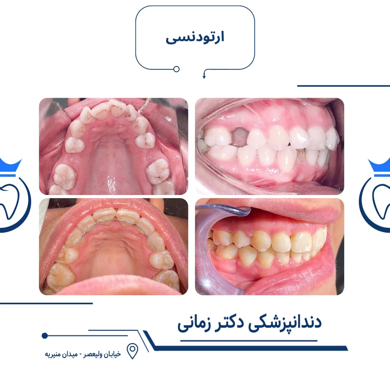 ارتودنسی ثابت و نامرئی (دیجیتال) با شرایط اقساط|خدمات زیبایی و سلامت|تهران, امیریه|دیوار