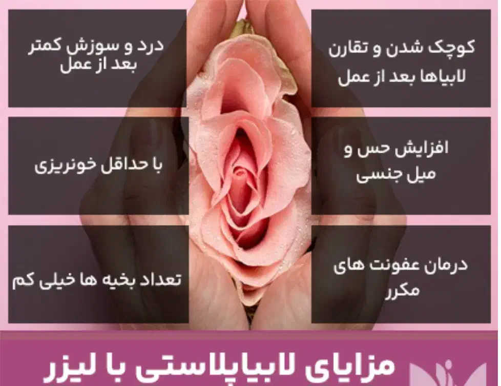 لابیاپلاستی با 50 درصد تخفیف|خدمات آرایشگری و زیبایی|شیراز, قصرالدشت|دیوار