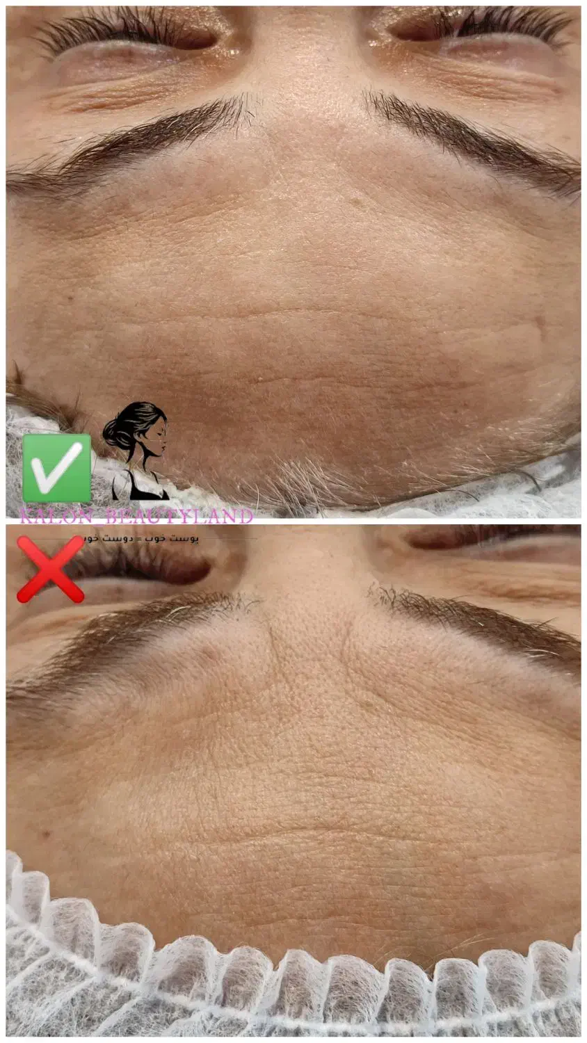 فیشال تخصصی پوست آقایان و بانوان|خدمات آرایشگری و زیبایی|گلبهار, شهر جدید گلبهار|دیوار