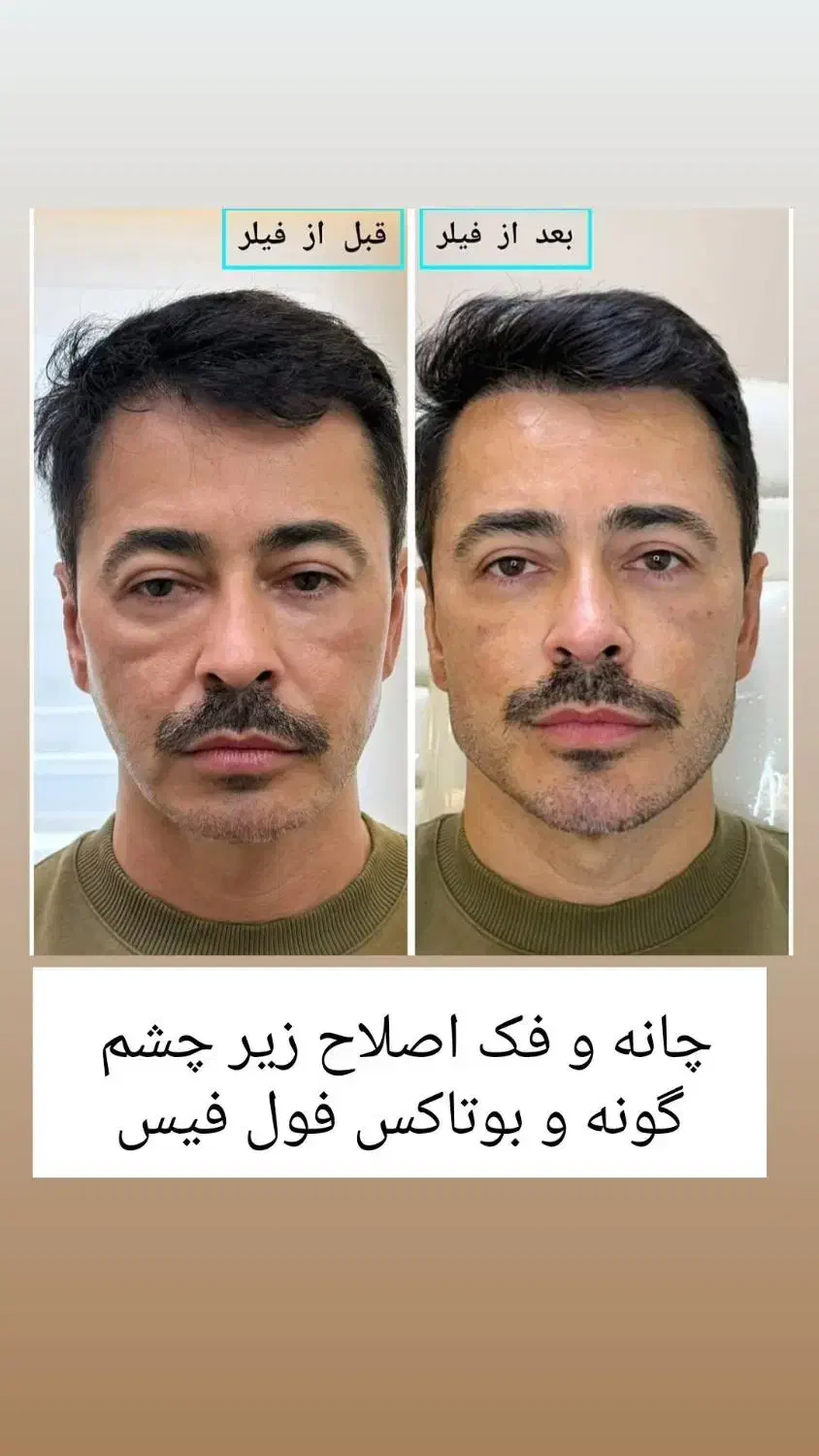 کلاس زیبایی برای همه|خدمات آموزشی|کرمانشاه, |دیوار