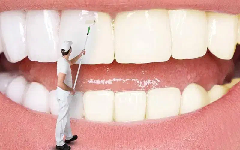سفید کننده دندان اصل|آرایشی، بهداشتی، درمانی|اهواز, زیتون کارمندی|دیوار