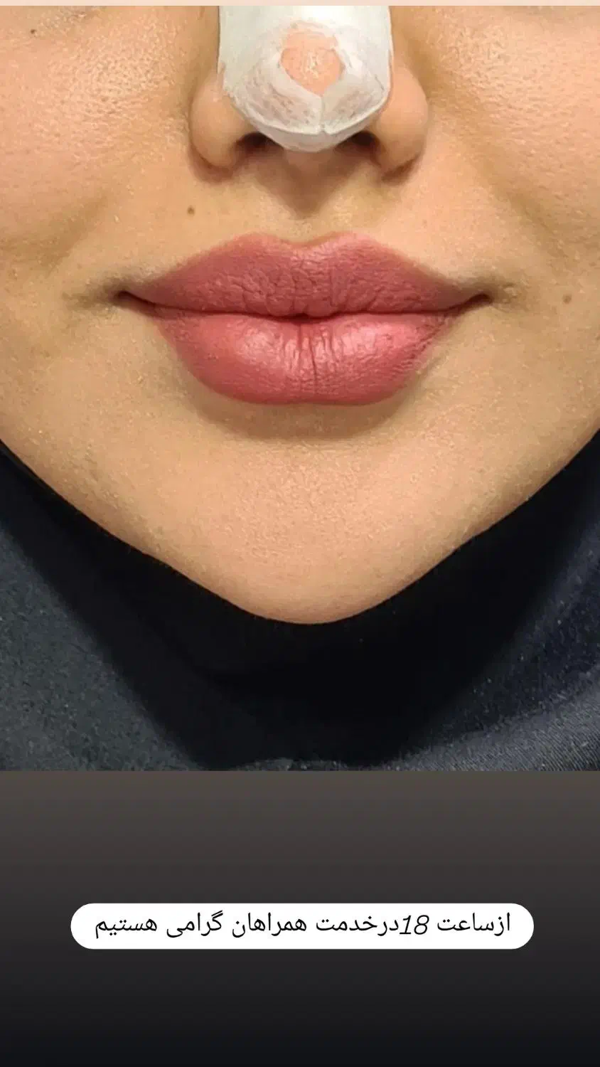 مطب دکتر پاک منش|خدمات آرایشگری و زیبایی|بهبهان, |دیوار