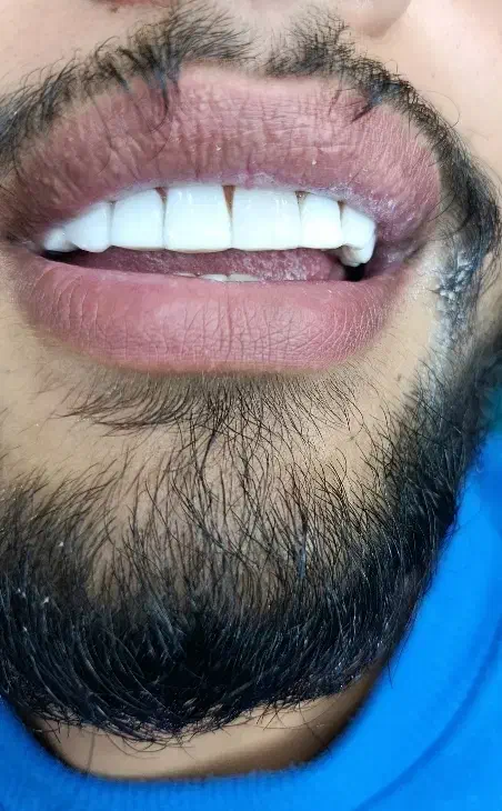 دندانپزشکی در خرم آباد با تخفیف ویژه|خدمات آرایشگری و زیبایی|دورود, |دیوار