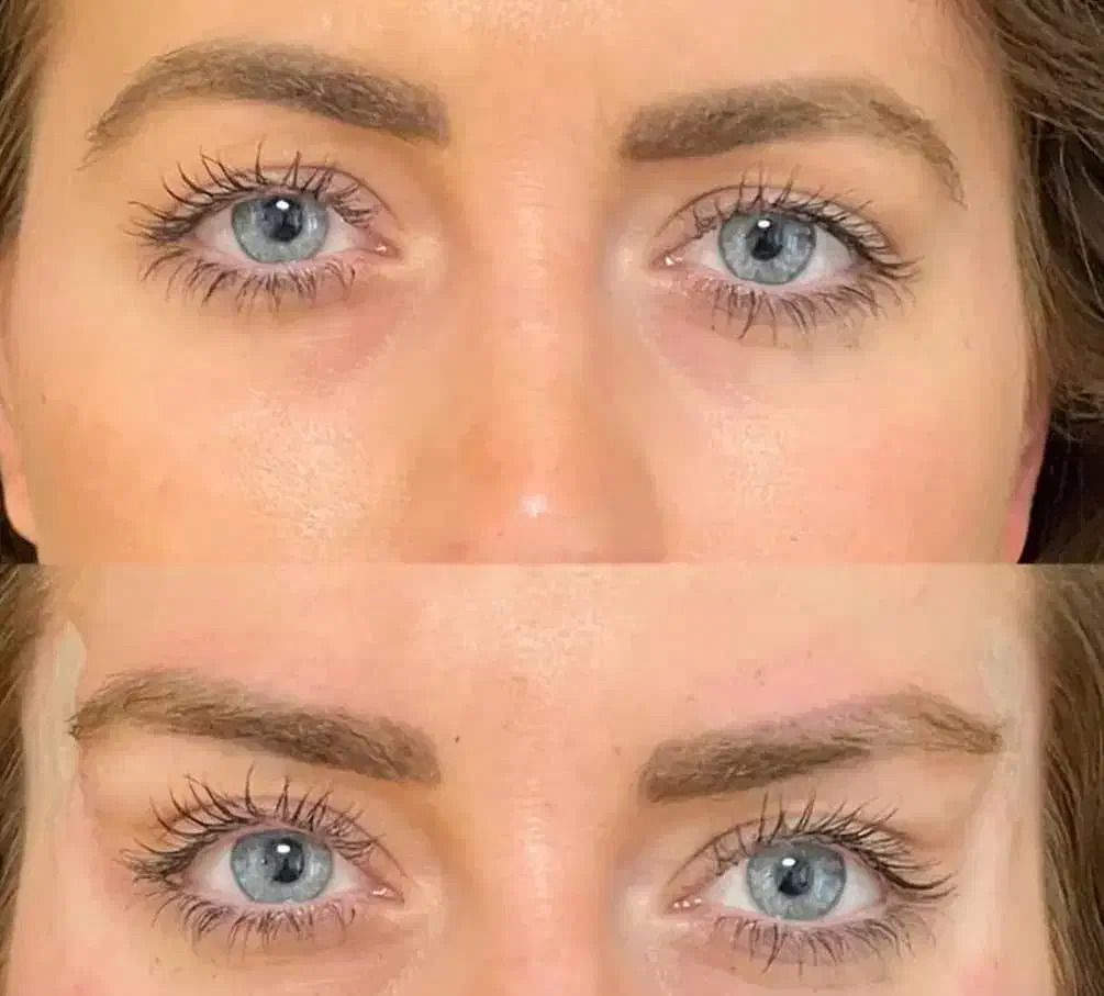 آموزش تزریق بوتاکس|خدمات آموزشی|فردیس, فرامرزیه|دیوار