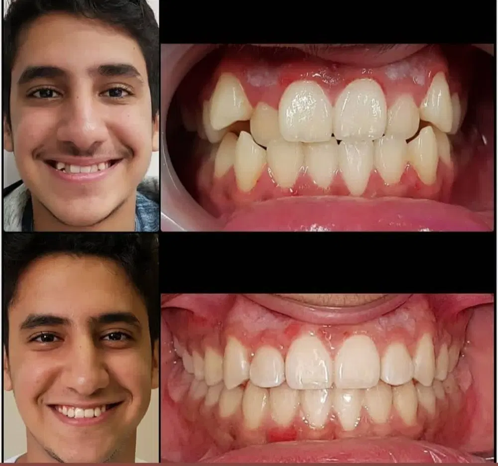 ارتودنسی از دم قسط، هرفک 55 میلیون (فقط تا 1 هفته)|خدمات زیبایی و سلامت|تهران, دروس|دیوار
