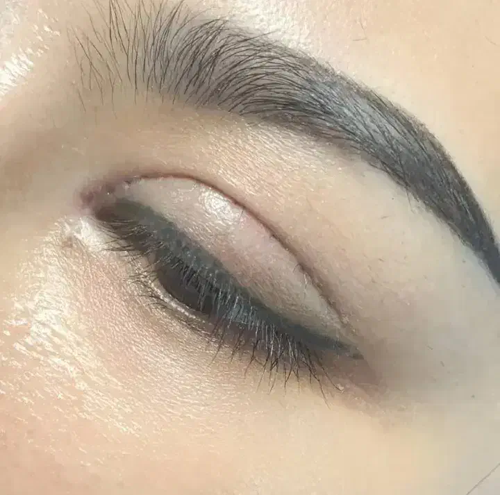 ساکشن غبغب|خدمات آرایشگری و زیبایی|تهران, شهرک گلها (تهرانسر)|دیوار