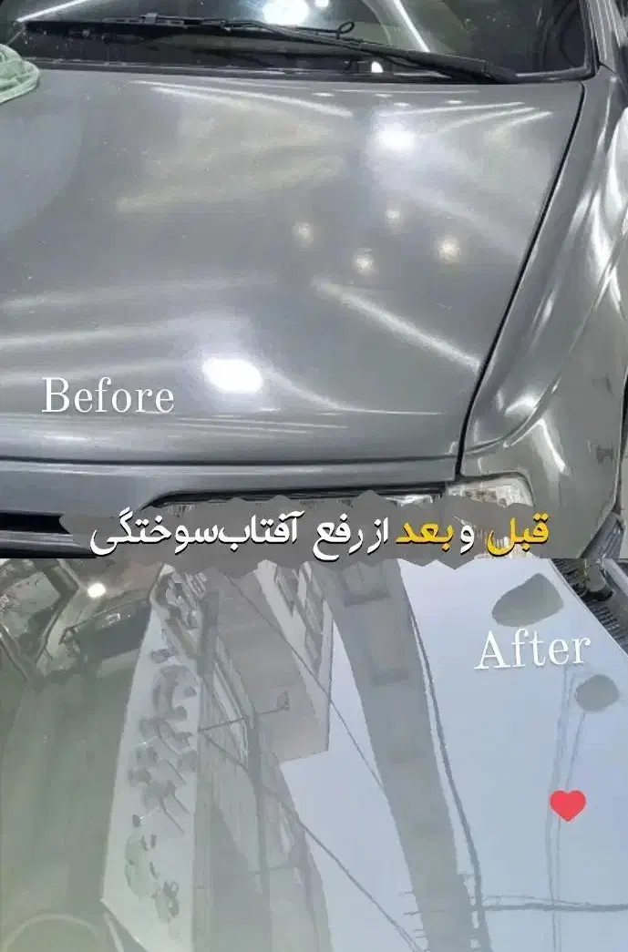 رفع آفتاب سوختگی|خدمات موتور و ماشین|قزوین, |دیوار