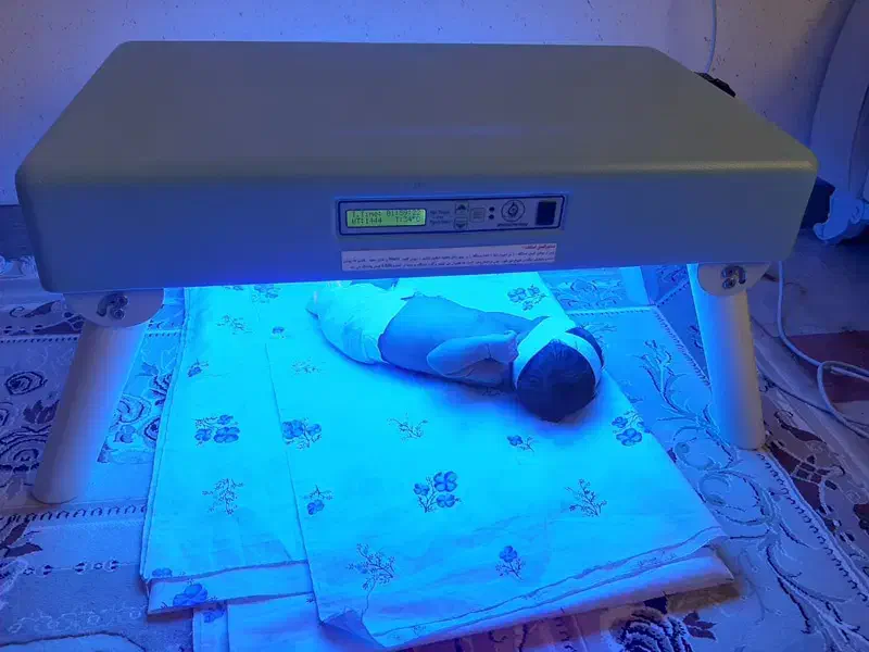 اجاره دستگاه اکسیژنساز و فتوتراپی زردی نوزاد|آرایشی، بهداشتی، درمانی|قزوین, |دیوار