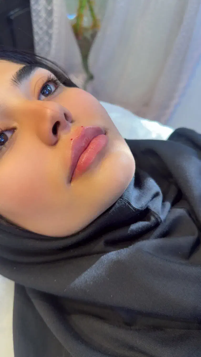 خدمات زیبایی ژل و بوتاکس|خدمات آرایشگری و زیبایی|محمودآباد, |دیوار