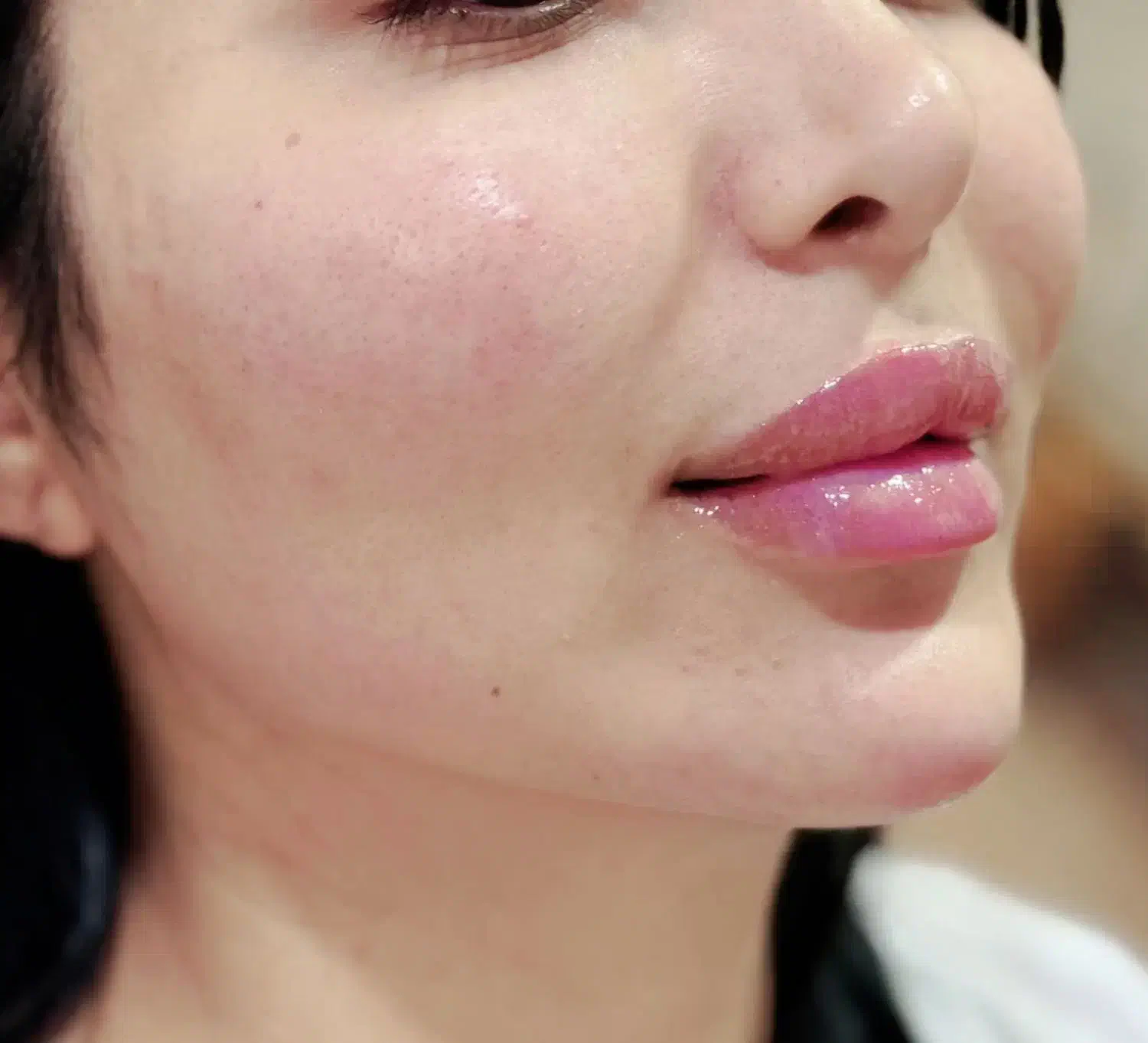 تزریق ژل و بوتاکس در کلینیک زیبایی|خدمات آرایشگری و زیبایی|کرمانشاه, |دیوار