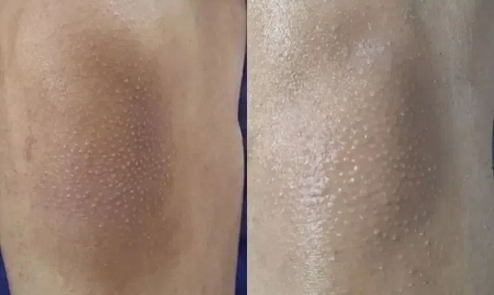 آموزش فیشال مبتدی و پیشرفته|خدمات آموزشی|آبادان, |دیوار