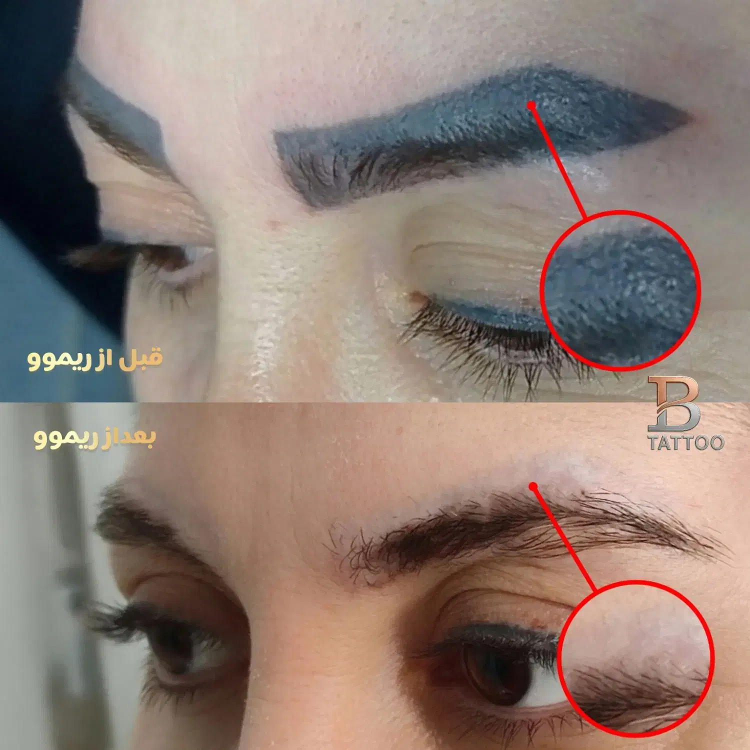 پاک کردن تتوابرو،خطچشم،خطلب(ریموو)|خدمات آرایشگری و زیبایی|شاهین‌شهر, شهرک میلاد|دیوار