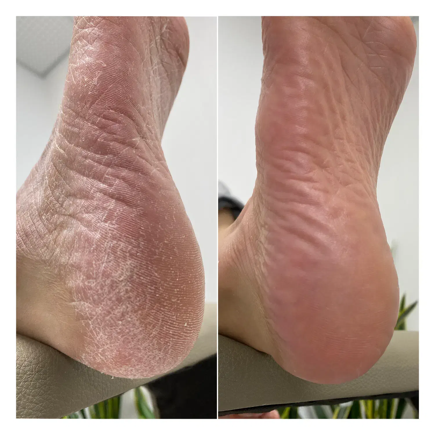 پدیکور درمانی و ریلکسی|خدمات آرایشگری و زیبایی|قائم‌شهر, |دیوار