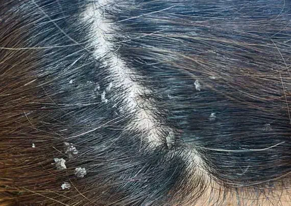 درمان انواع مشکلات پوست و مو|آرایشی، بهداشتی، درمانی|بروجرد, |دیوار