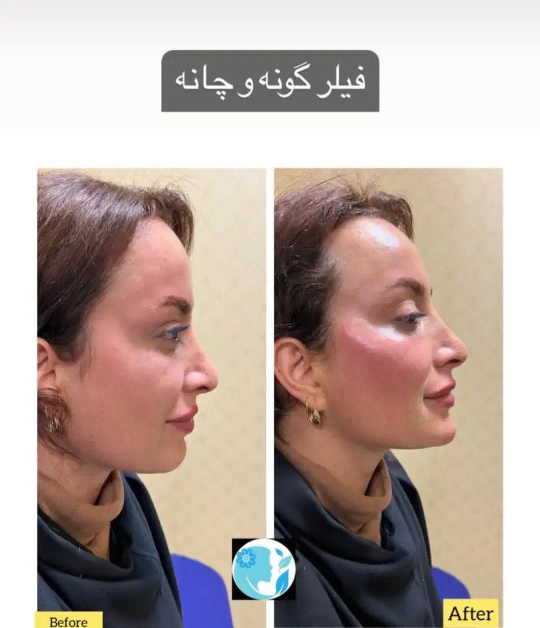 کلینیک پوست و مو و لیزر و زیبایی در اسلامشهر|خدمات آرایشگری و زیبایی|اسلام‌شهر, باغ فیض|دیوار