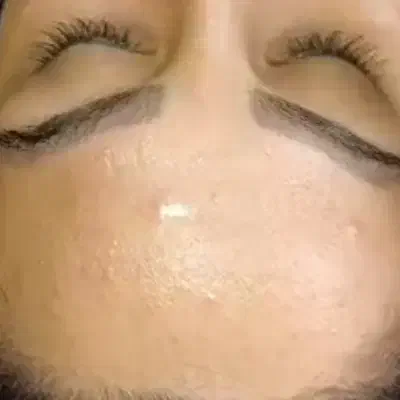 فیشیال تخصصی صورت|خدمات آرایشگری و زیبایی|قم, صدوق|دیوار