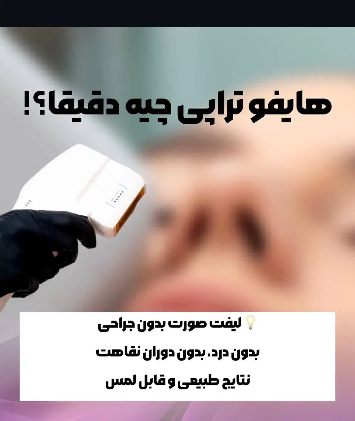 هایفوتراپی صورت. رفع غبغب. لاغری با قیمت ۲۵۰۰|خدمات آرایشگری و زیبایی|شاهین‌شهر, خانه کارگر|دیوار