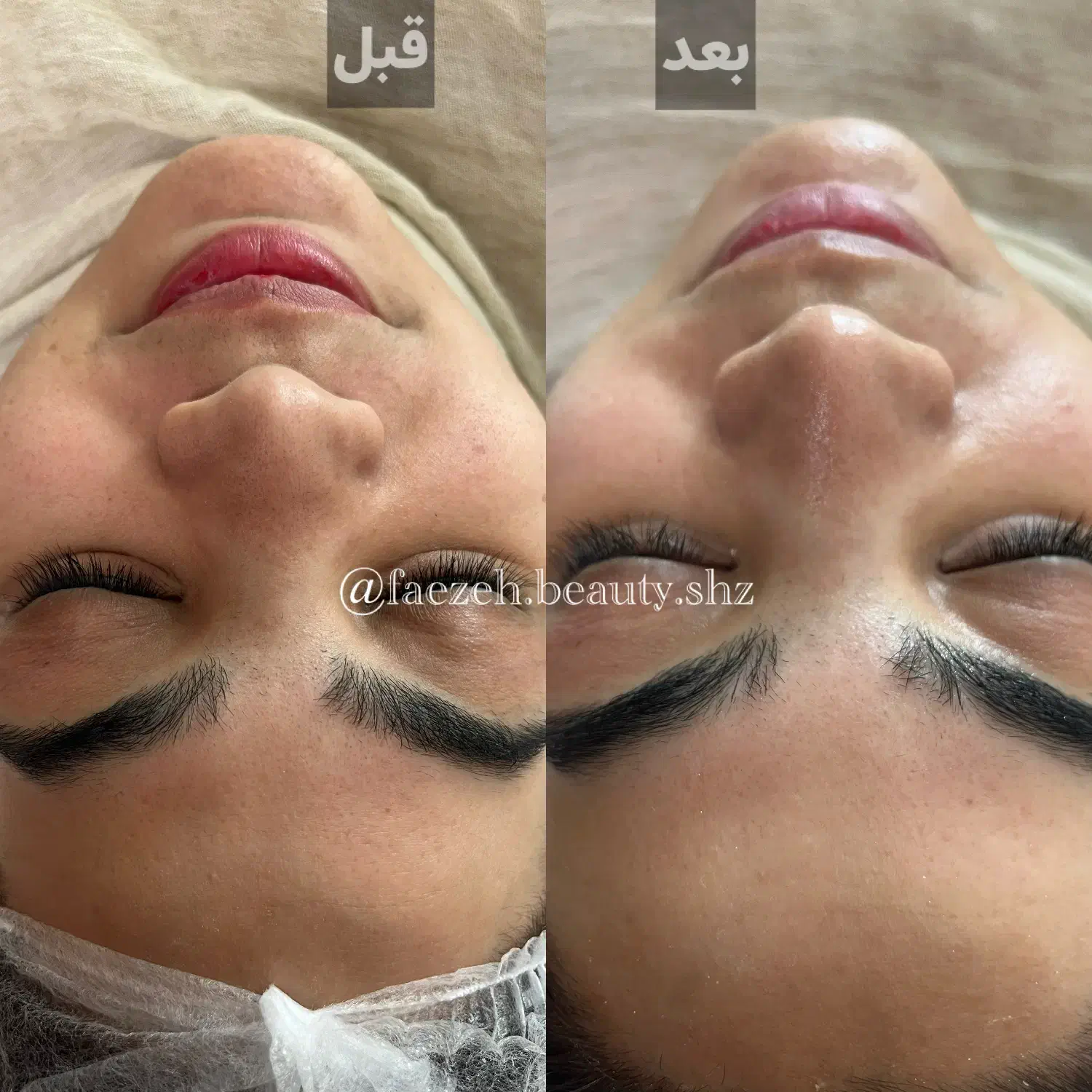 مدل فیشیال با تخفیف بابرند اکلادو|خدمات آرایشگری و زیبایی|شیراز, قالیشویی|دیوار