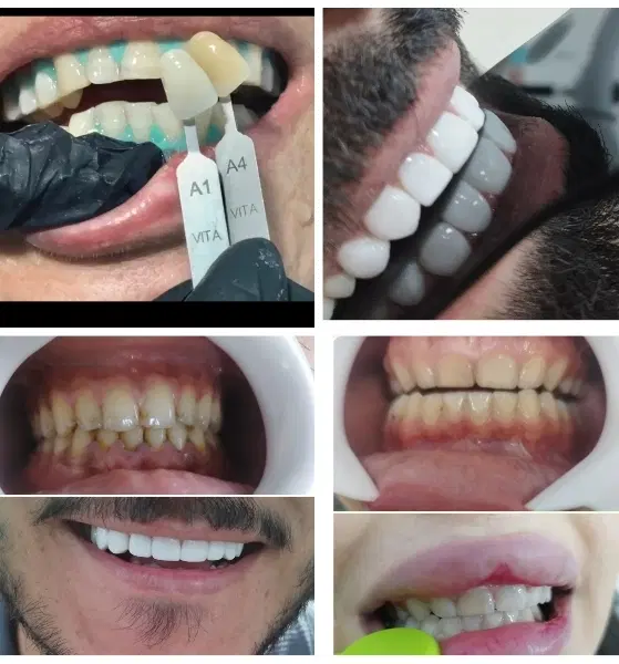 دندان|خدمات آرایشگری و زیبایی|بندر ماهشهر, |دیوار