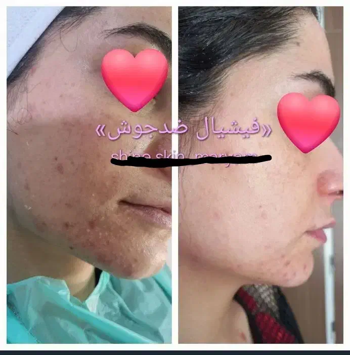 مرکز پاکسازی تخصصی جوان سازی پوست و اموزشvip|خدمات آرایشگری و زیبایی|مرودشت, بیست متری بیمارستان|دیوار