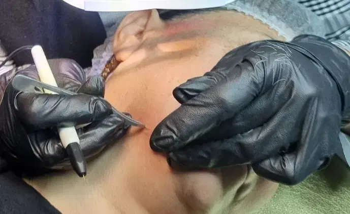 لیزر موهای سفید و سیاه با جدیدترین دستگاه‌ها|خدمات آرایشگری و زیبایی|رشت, گلسار|دیوار