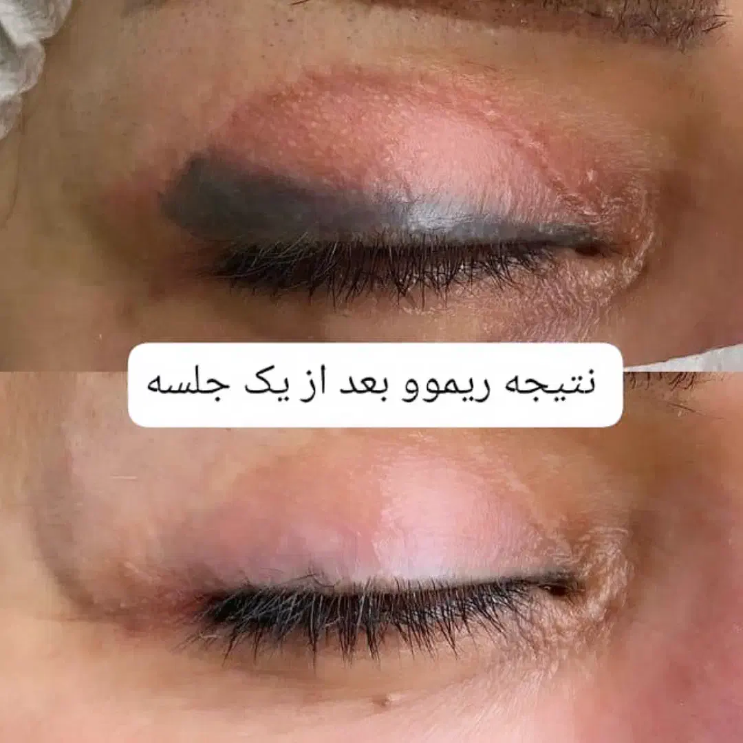 تخفیف ۴۰ درصدی ریموو ومیکرو ابرو برای ۵ نفر اول|خدمات آرایشگری و زیبایی|ورامین, ورامین|دیوار