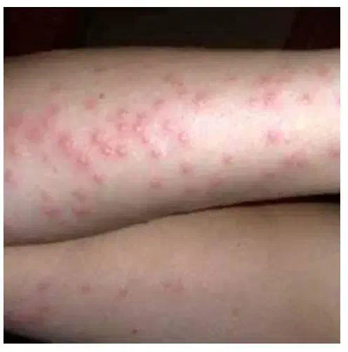 سم پاشی وضدعفونی اماکن ومنازل باسابقه ۱۴سال|خدمات نظافت|گرگان, |دیوار