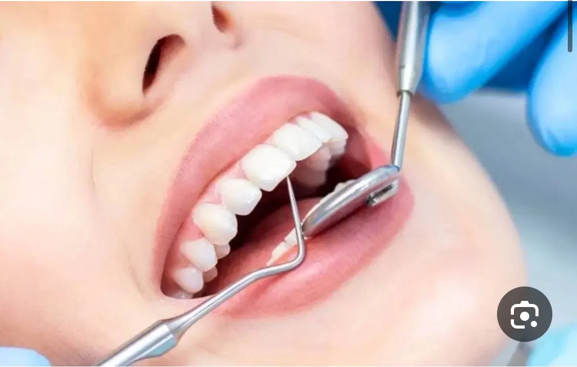 عصب کشی و دندان مصنوعی با کمترین قیمت|خدمات زیبایی و سلامت|تهران, آجودانیه|دیوار
