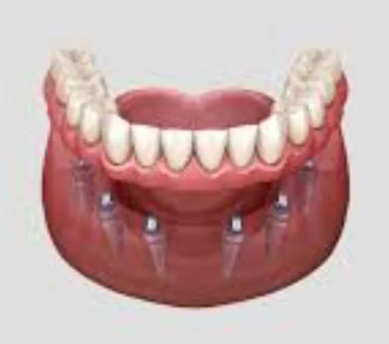 لابراتوار دندانسازی استخدام منشی خانم|استخدام اداری و مدیریت|تهران, عباسآباد|دیوار