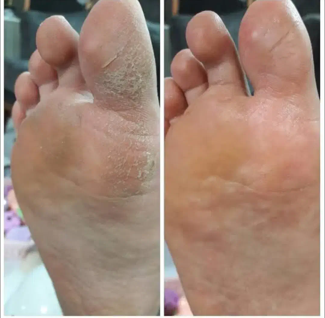 پدیکور|خدمات آرایشگری و زیبایی|سقز, |دیوار