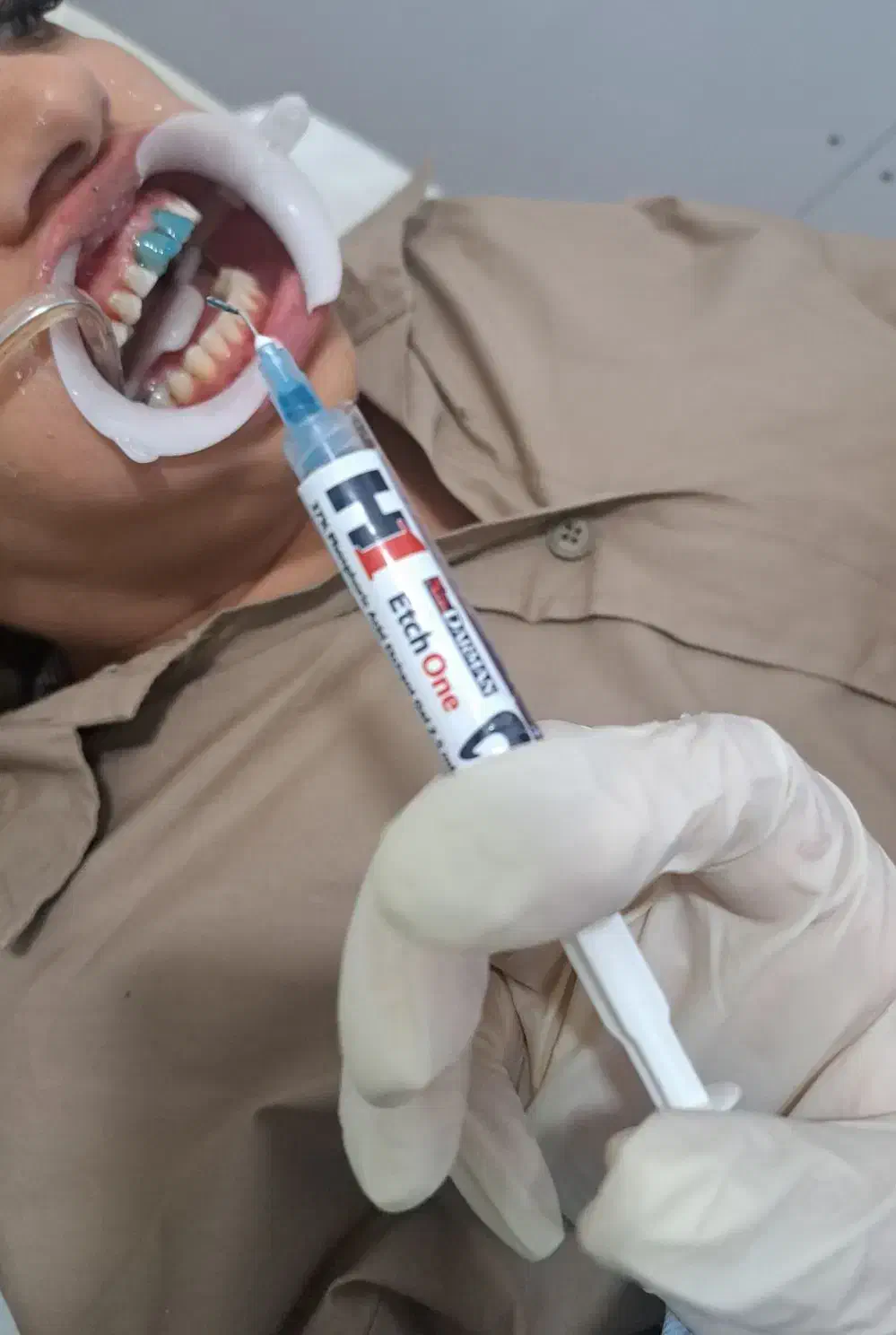 آموزش کامپوزیت دندان۱۰تومن|خدمات آموزشی|اهواز, رسالت|دیوار