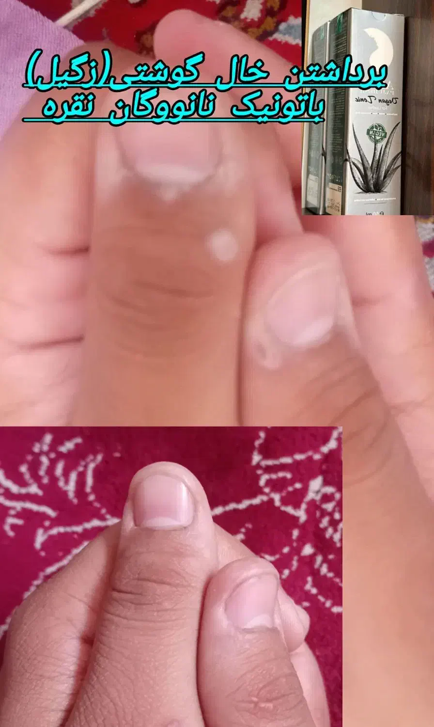 نانووگان نقره نرم کننده وترمیم کننده|آرایشی، بهداشتی، درمانی|مرودشت, فاز دوم شهرک فرهنگیان|دیوار