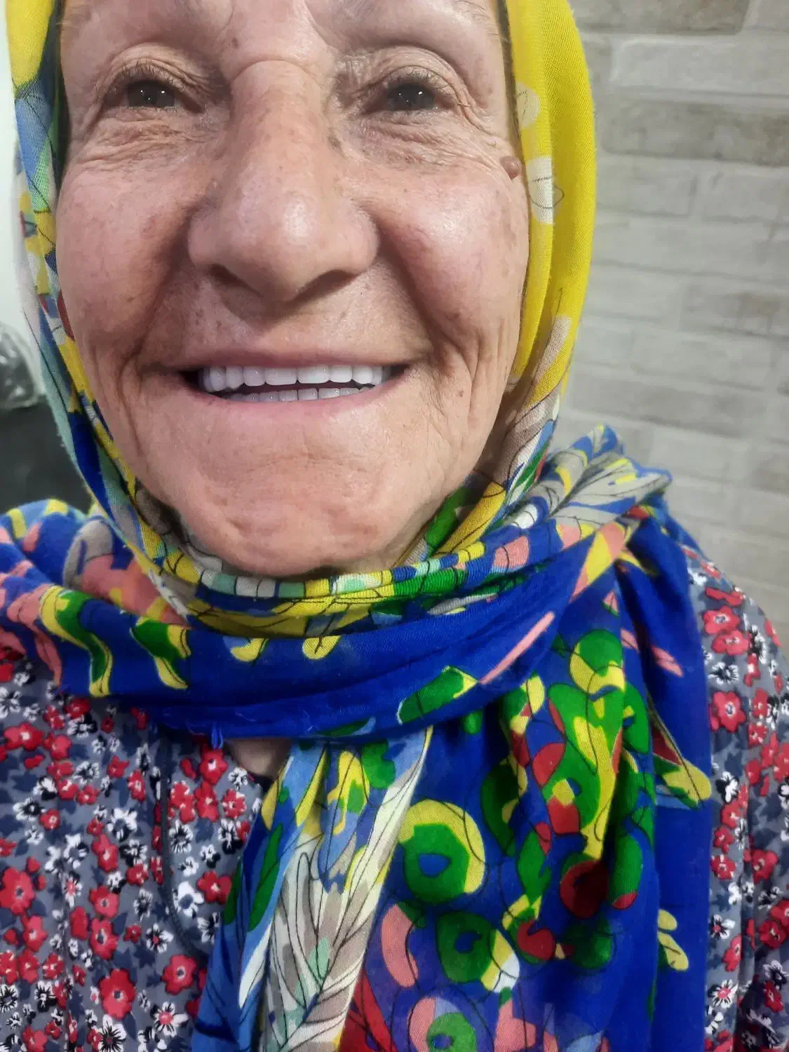 جشنواره مرکزدست دندان وساخت دندانهای مصنوعی ژلهای|خدمات آرایشگری و زیبایی|کرج, مطهری|دیوار