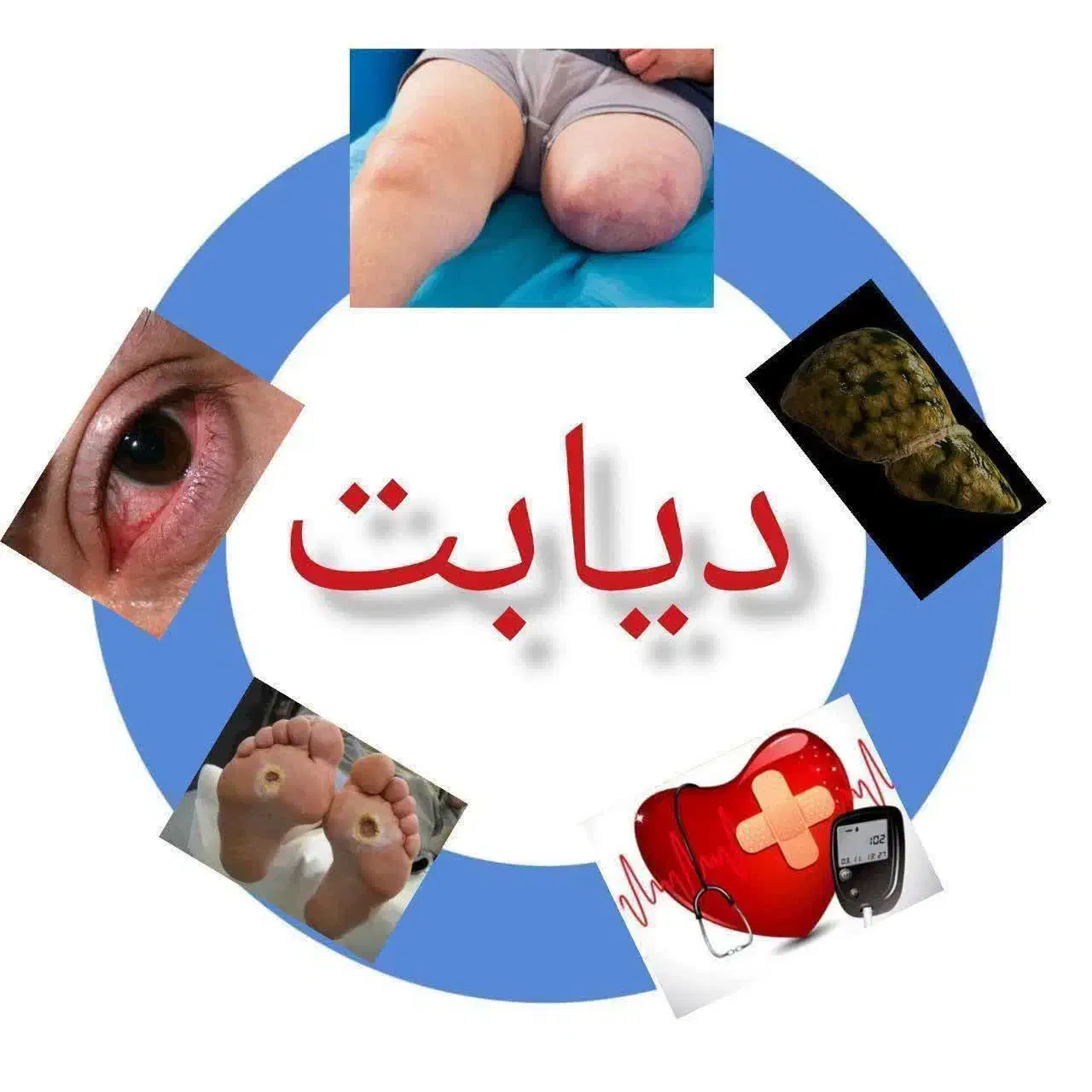 دیابت|خدمات آرایشگری و زیبایی|تهران, امام زاده عبدالله|دیوار