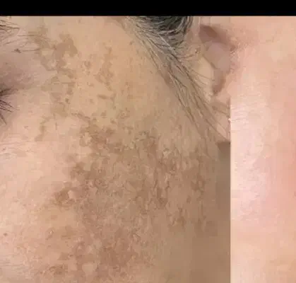 کک ومک|فعالیت داوطلبانه تحقیقاتی|شیروان (لرستان), |دیوار