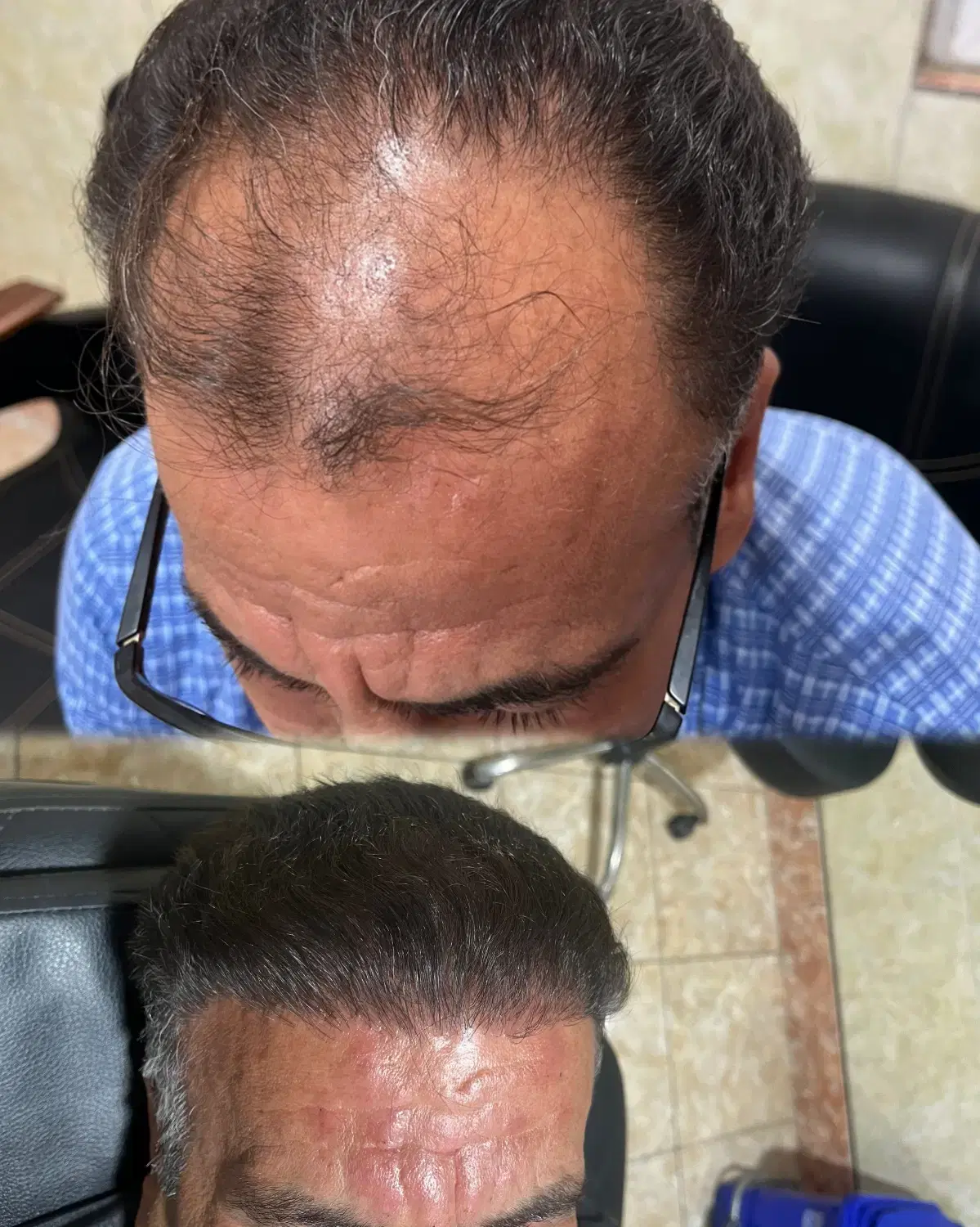 کاشت|خدمات آرایشگری و زیبایی|دورود, |دیوار