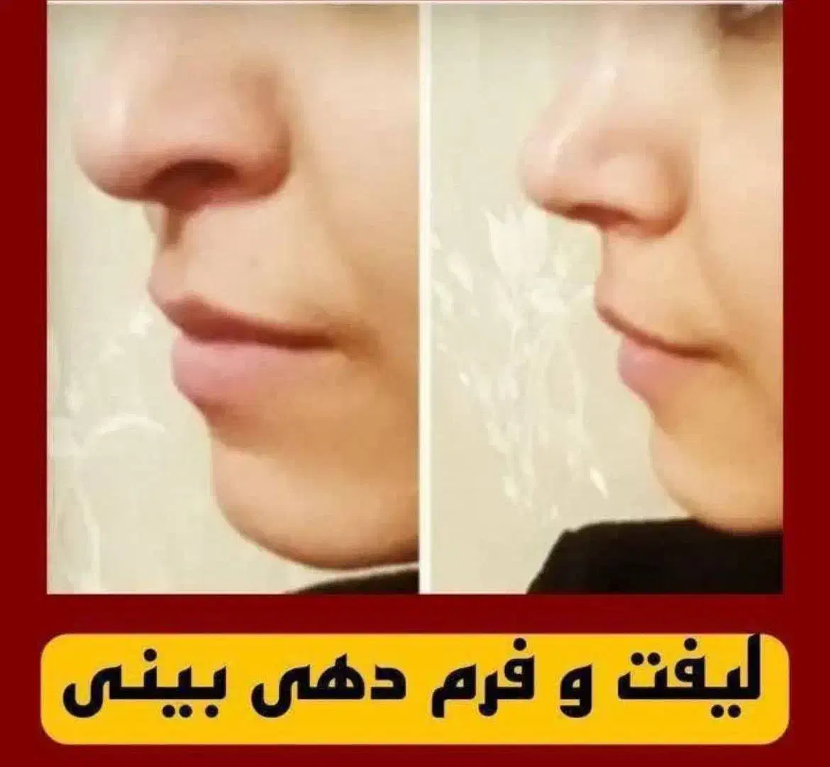 کرم کوچیک کننده بینی|آرایشی، بهداشتی، درمانی|قرقری, |دیوار