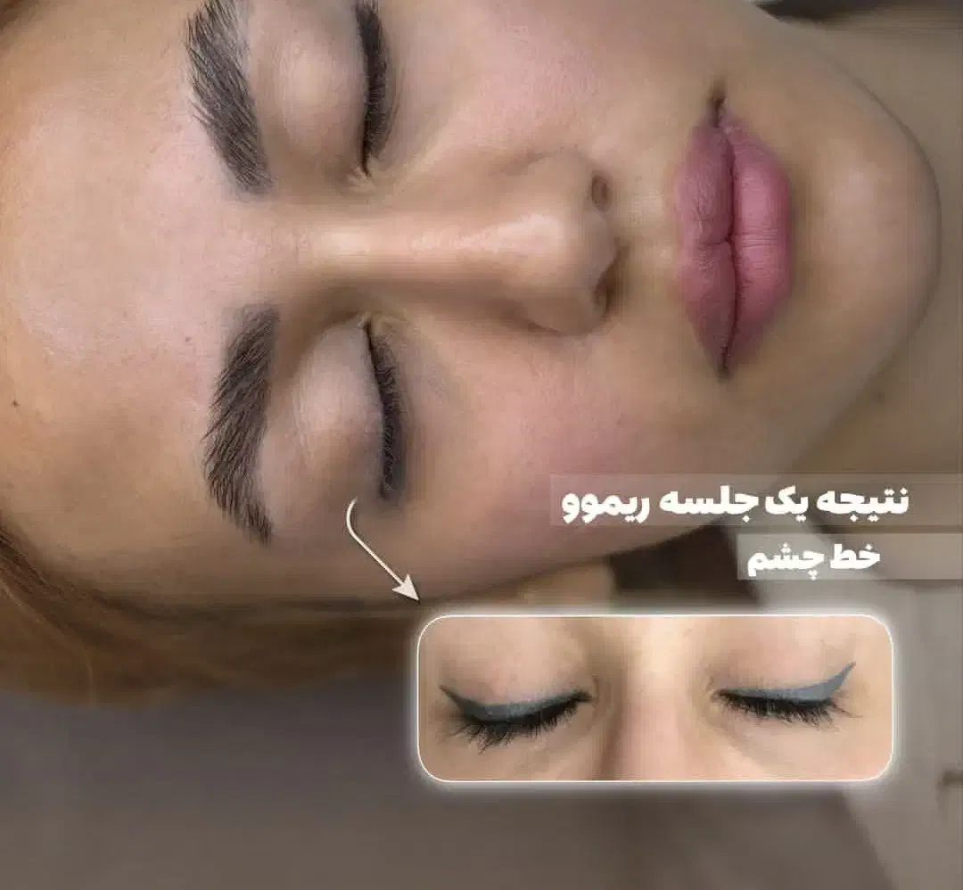 ریمو پاک کردن خط چشم وابرو دریک جلسه|خدمات آرایشگری و زیبایی|پارسآباد, |دیوار