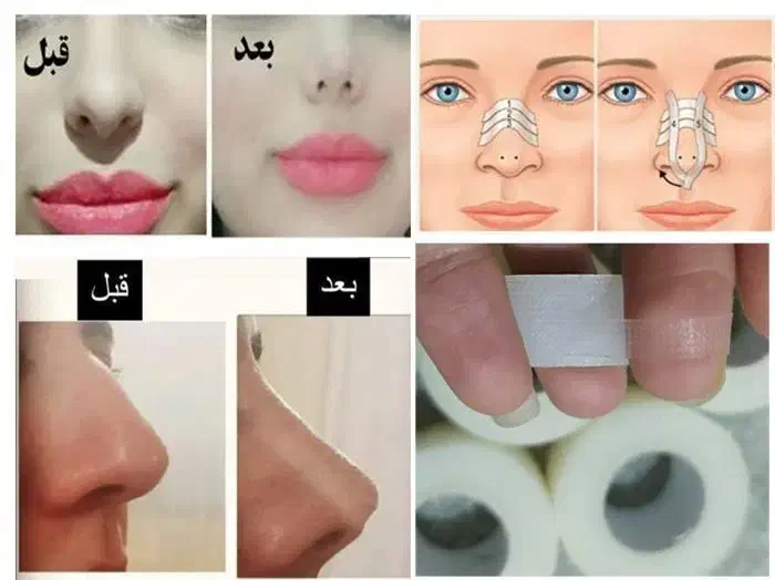 چسب لیفت بینی و شقیقه لوازم ارایشی|آرایشی، بهداشتی، درمانی|چناران, |دیوار