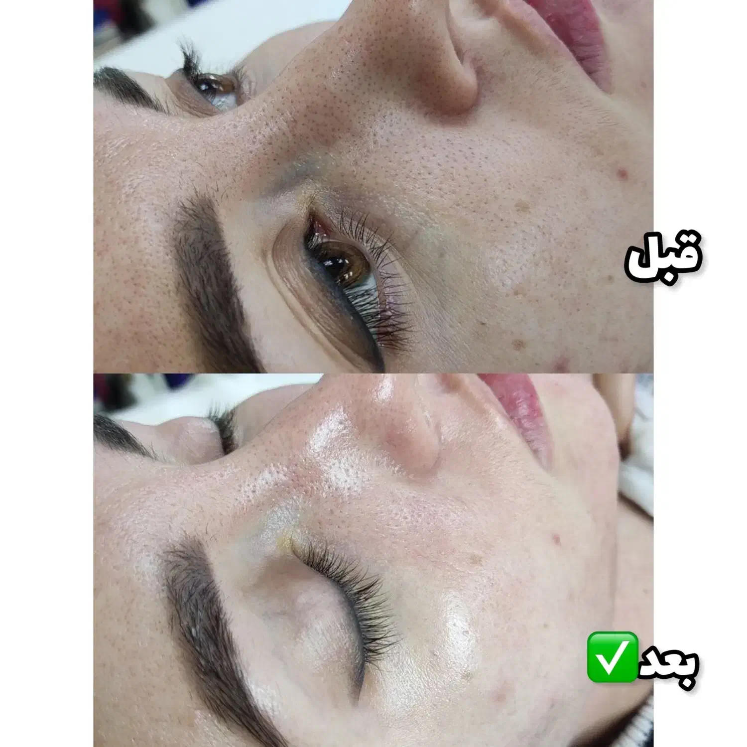 پاکسازی پوست تخفیف یلدا تضمینی|خدمات آرایشگری و زیبایی|ارومیه, |دیوار