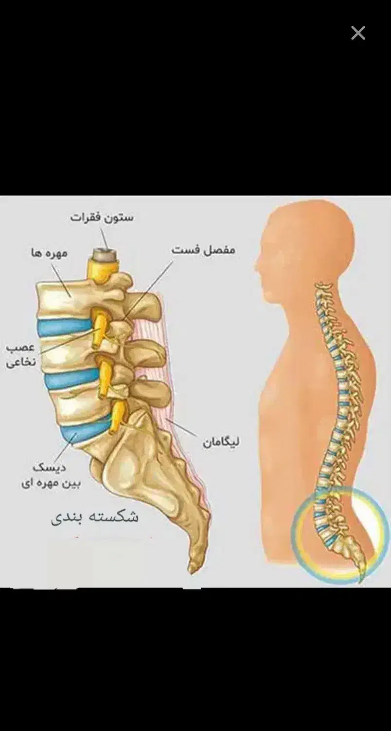 طب الحسین۱۱۰ درمان دیسک کمرتخصصی|خدمات آرایشگری و زیبایی|اسلام‌شهر, شهرک مفیدی|دیوار