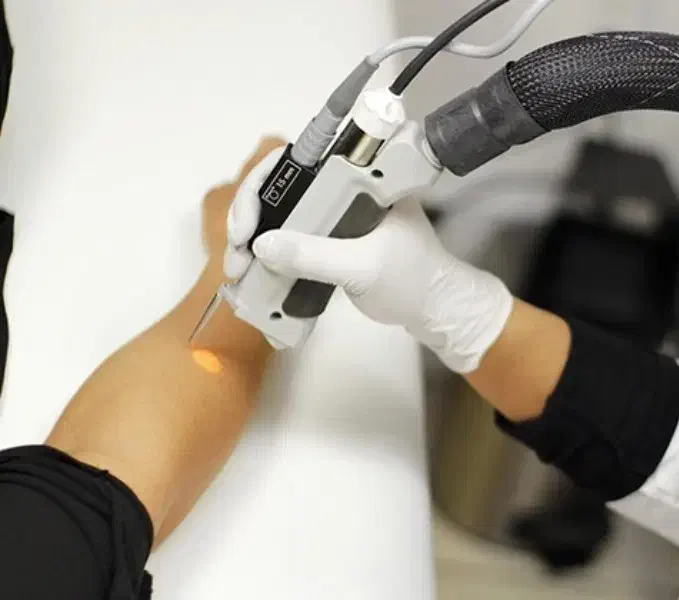 استخدام اپراتور لیزر|استخدام درمانی، زیبایی، بهداشتی|یزد, |دیوار