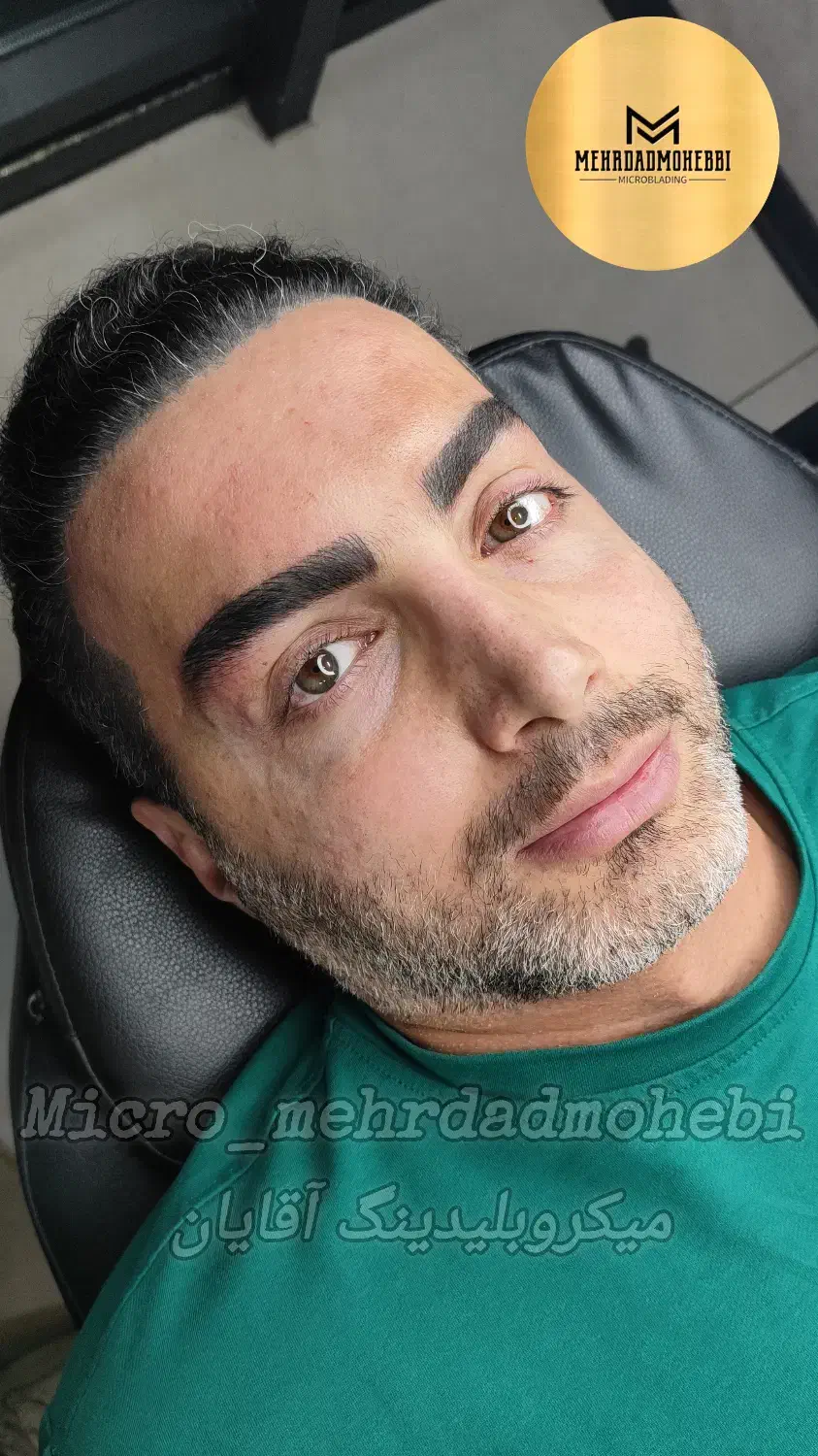 میکروبلیدینگ ابرو/رفع تیرگی لب/اسکالپ سر|خدمات آرایشگری و زیبایی|تهران, نیاوران|دیوار