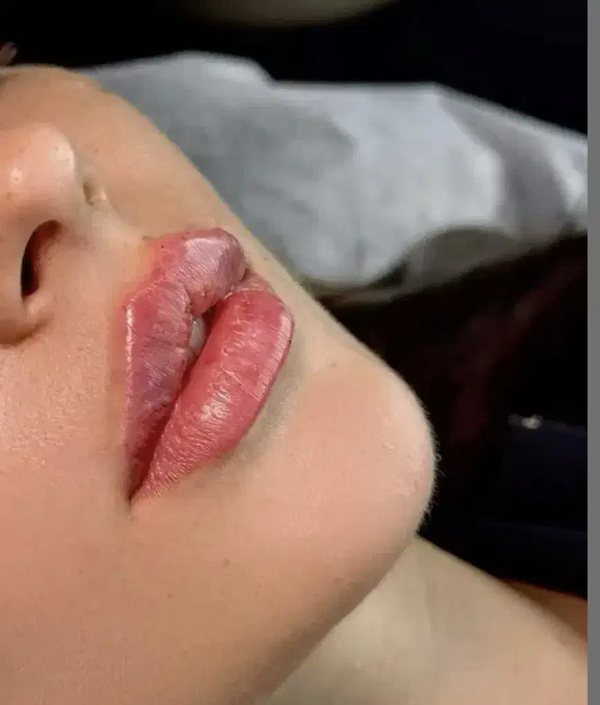 جشنواره یلدایی تخفیف ژل لب،بوتاکس توسط پزشک متخصص|خدمات آرایشگری و زیبایی|کرج, گلشهر|دیوار