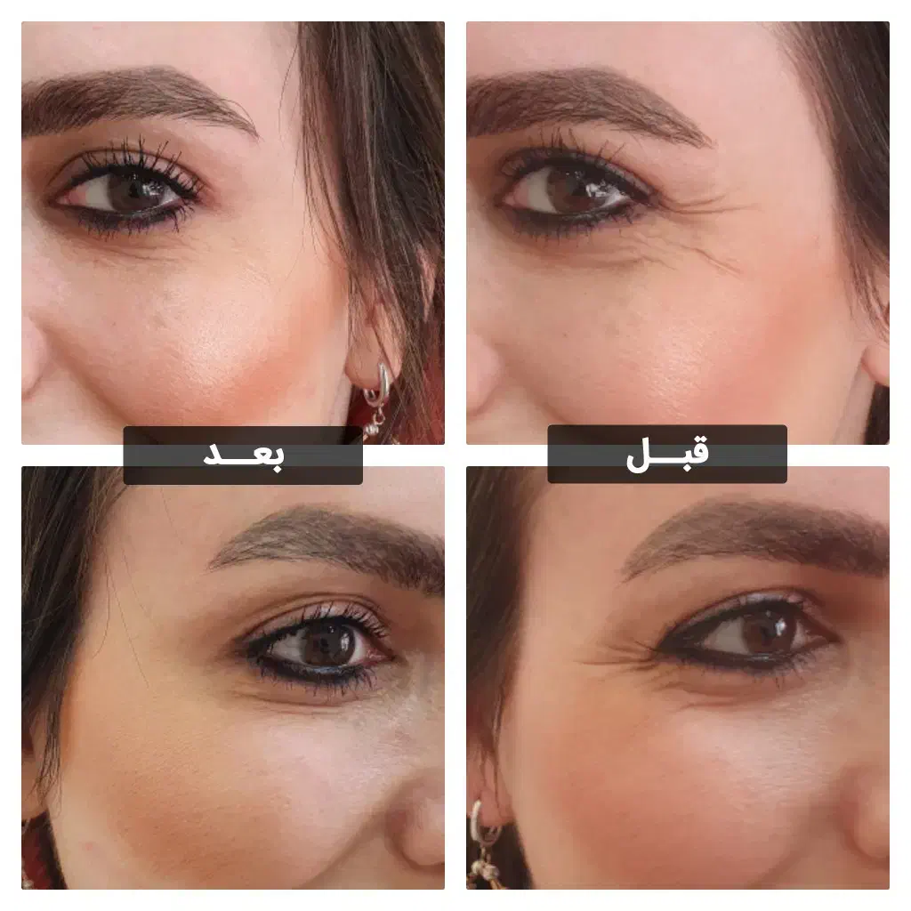 مدل ژل کل صورت|خدمات آرایشگری و زیبایی|اصفهان, ملکشهر|دیوار